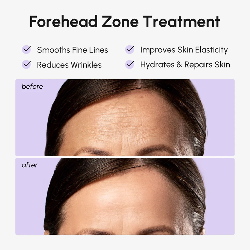 Anti-Wrinkle Forehead Patches – Smooth Lines Overnight
